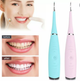 Ultrasonic Portable Electric Dental Teeth Cleanner